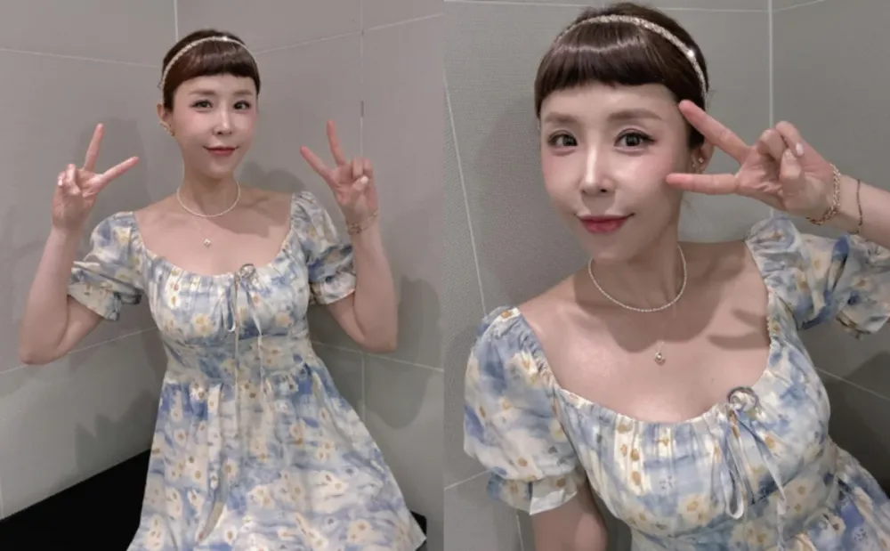 Stulbinanti Shinji transformacija po dvigubos akių vokų peržiūros operacijos