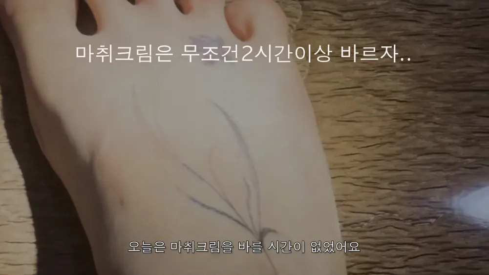 Nana partage le douloureux voyage pour son retrait de tatouage
